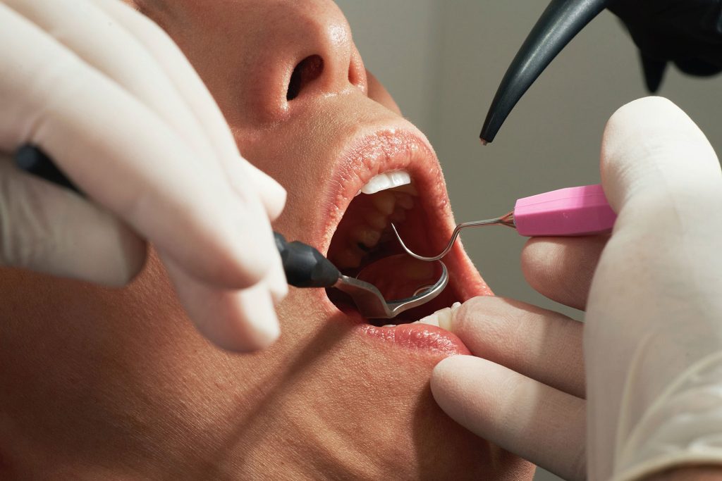 Complicaciones en cirugía maxilofacial: prevención y manejo