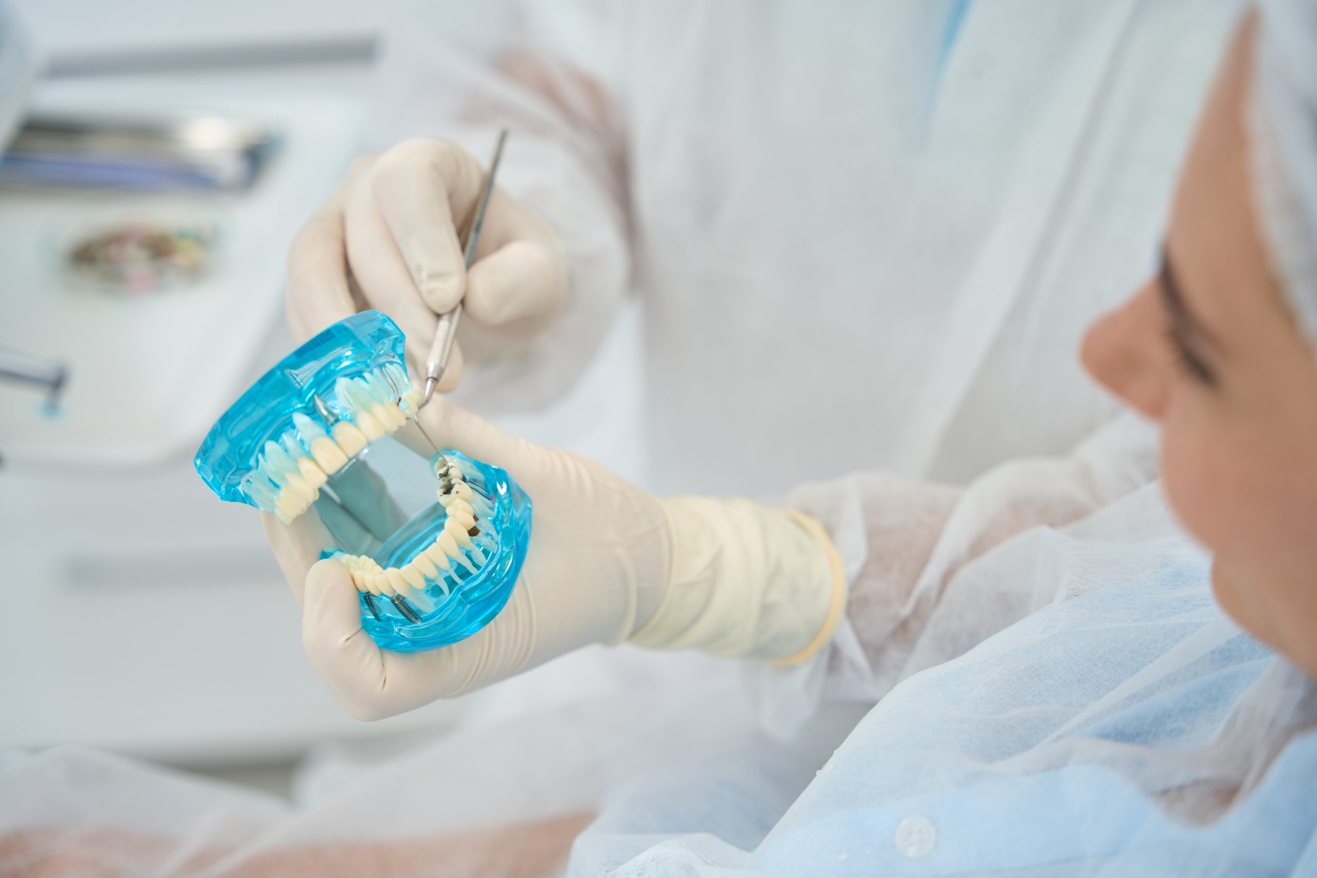 Cuidados y mantenimiento de implantes dentales