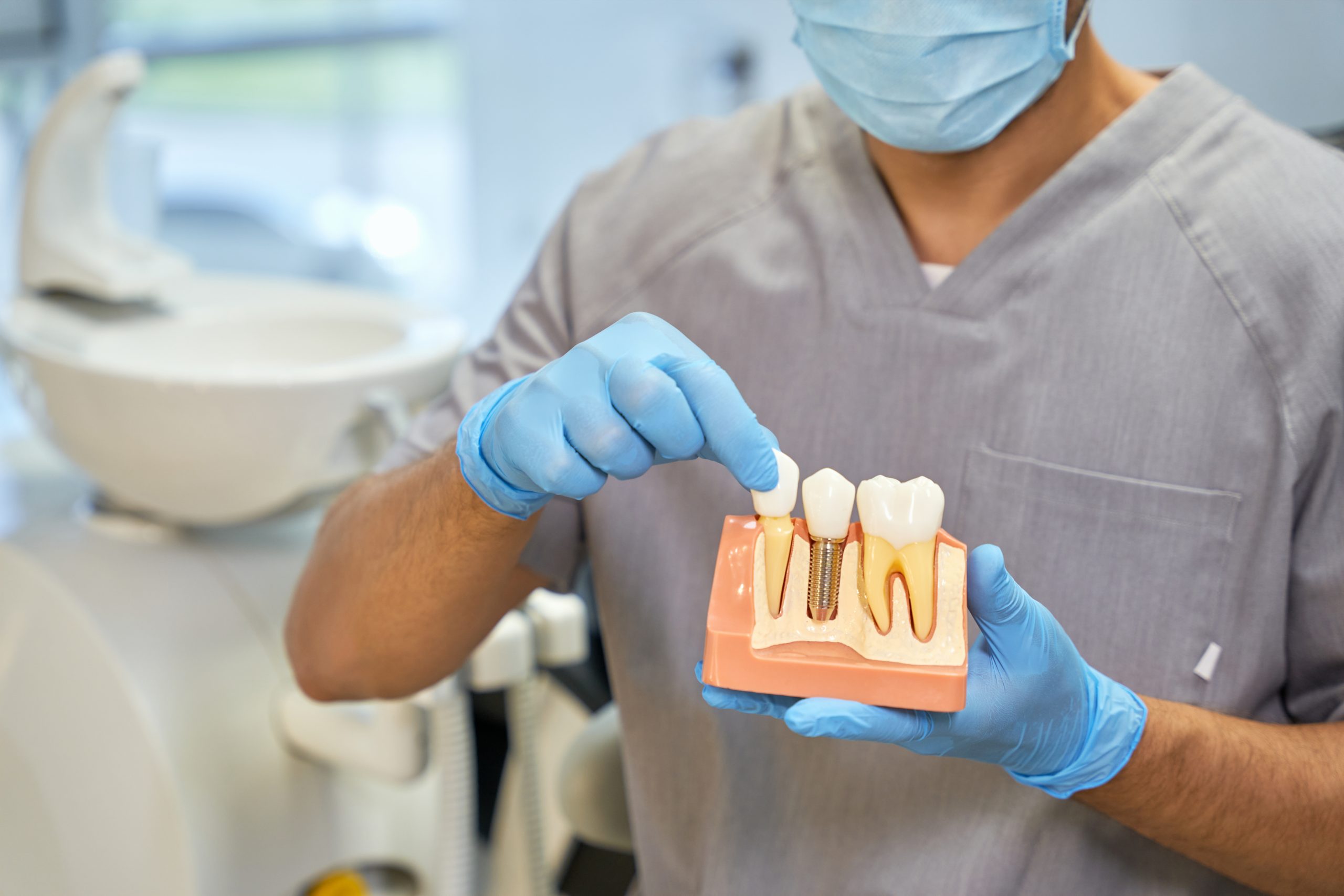 El proceso de colocación de implantes dentales