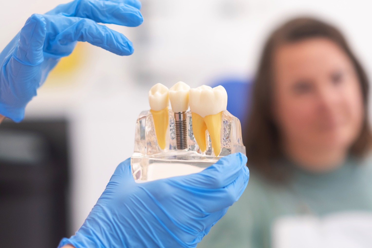 Bioimplantes Dentales Regenerativos