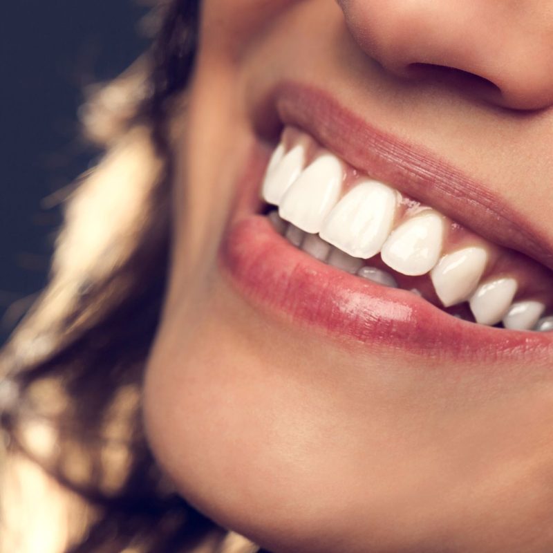 Cómo Afecta la Genética a tu Sonrisa