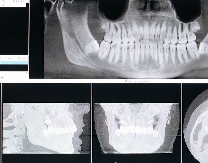 diferencia entre ortodoncista y maxilofacial