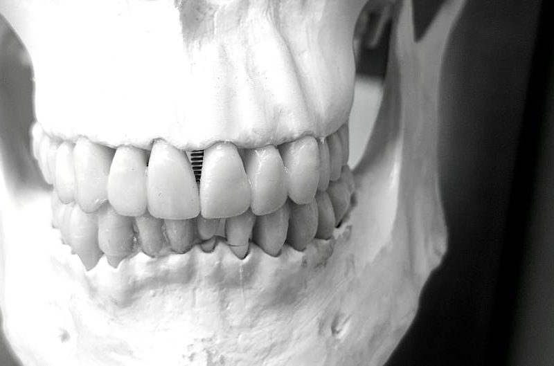 qué es la cirugía maxilofacial